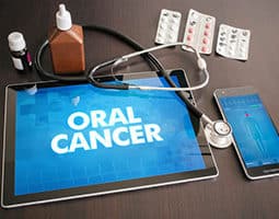 VelScope Oral Cancer Screening