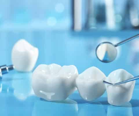 Dental Bridges in Lisle, Illinois